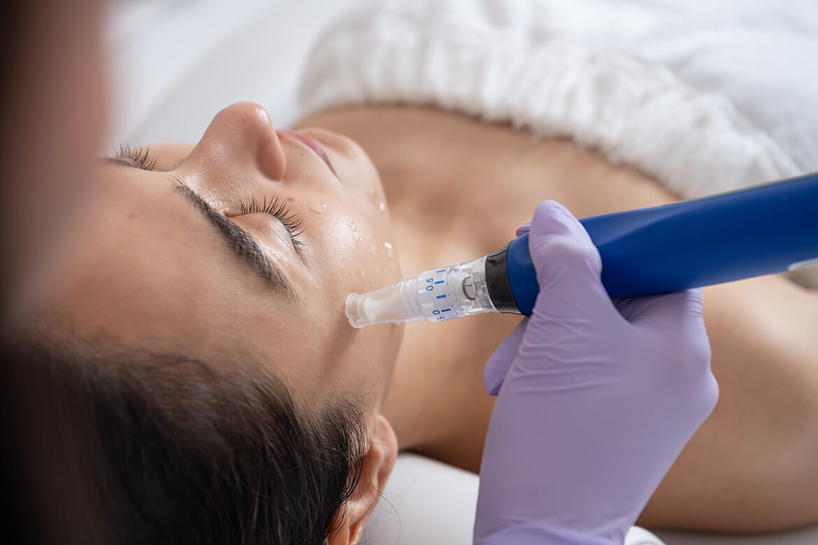 Microneedling is a procedure that pokes holes in the skin surface to stimulate collagen production and create a more youthful appearance.