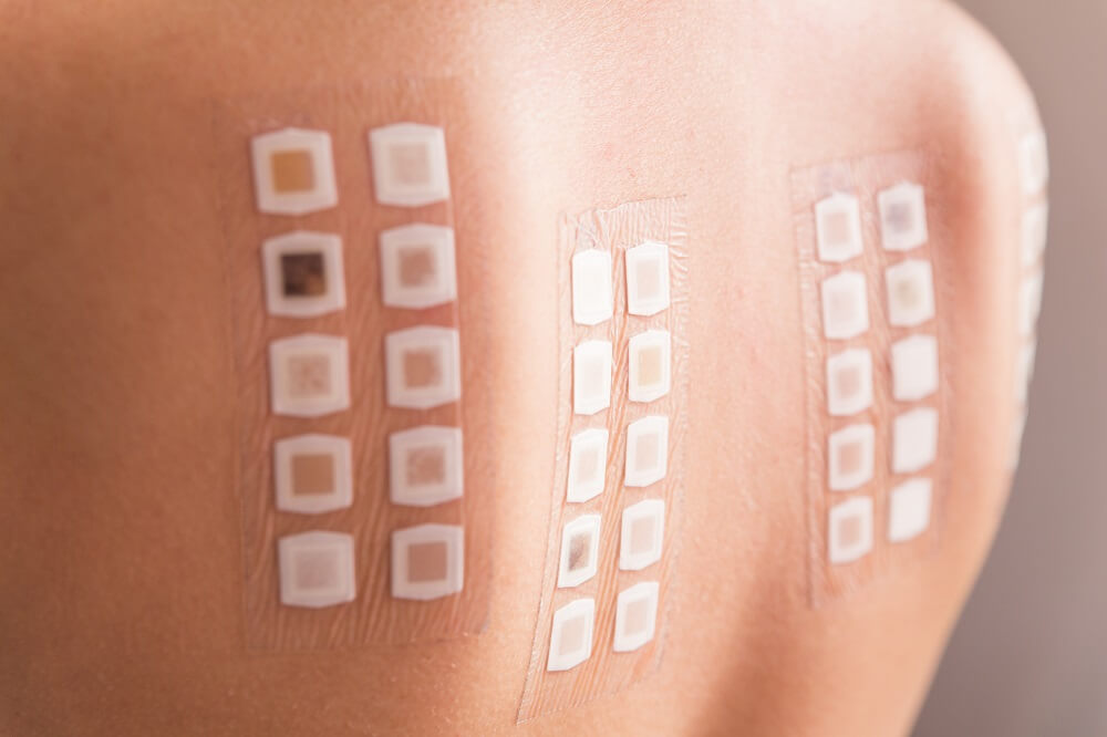 Patch tests  Dermatology Laser Clinic