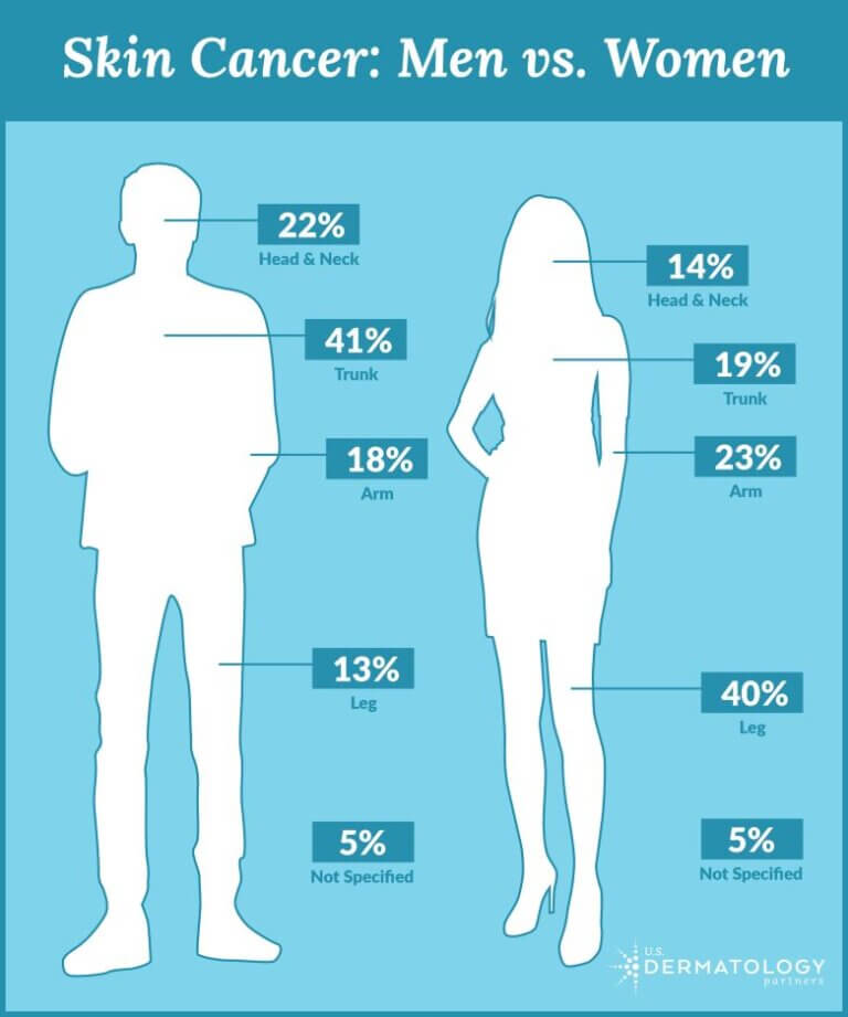 Skincare FAQs | Skin Cancer in Men vs in Women | Who is more at risk?