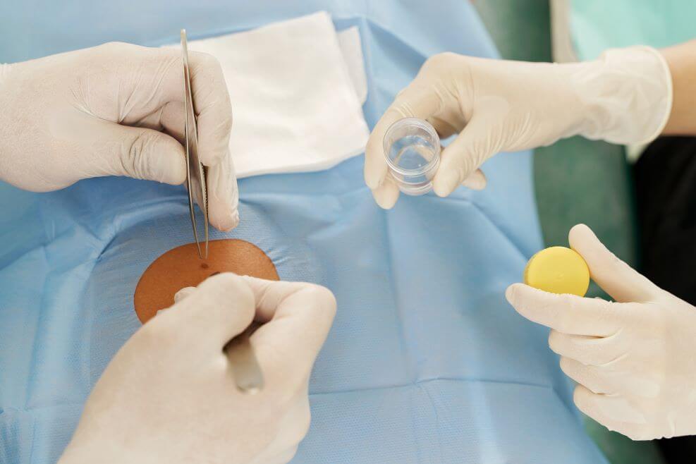 Dermatologist performing a skin biopsy