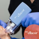 Ellacor is an innovative, first of its kind treatment that utilizes newly developed micro-coring technology to improve the appearance of moderate to severe wrinkles and excess skin.
