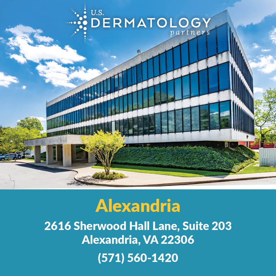 U.S. Dermatology Partners is your specialty dermatologist in Alexandria, Virginia. We offer treatment for acne, eczema, skin cancer, & more.