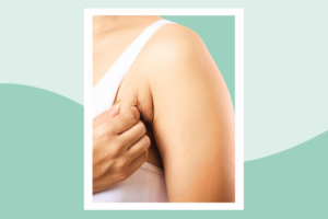 Everyday Health - Dealing with an Armpit Rash Here’s What You Need to Know - Dr. Kathryn Celeste Durham