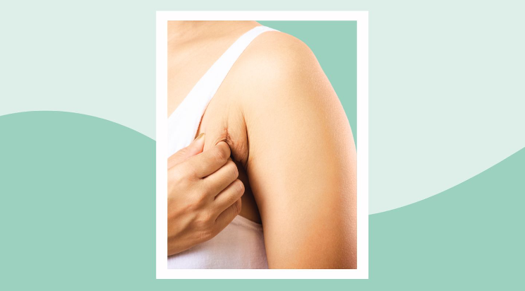 Everyday Health - Dealing with an Armpit Rash Here’s What You Need to Know - Dr. Kathryn Celeste Durham